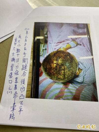 鄰居持刀劈頭割頸辯自衛 舞蹈老師出庭怒罵：本末倒置